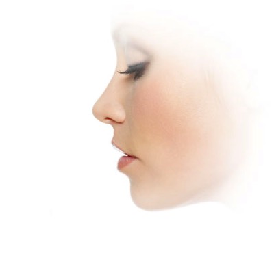 Rhinoplasty